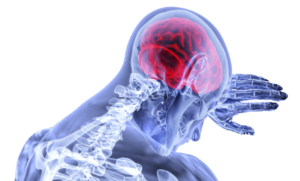 Traumatic Brain Injuries in South Carolina